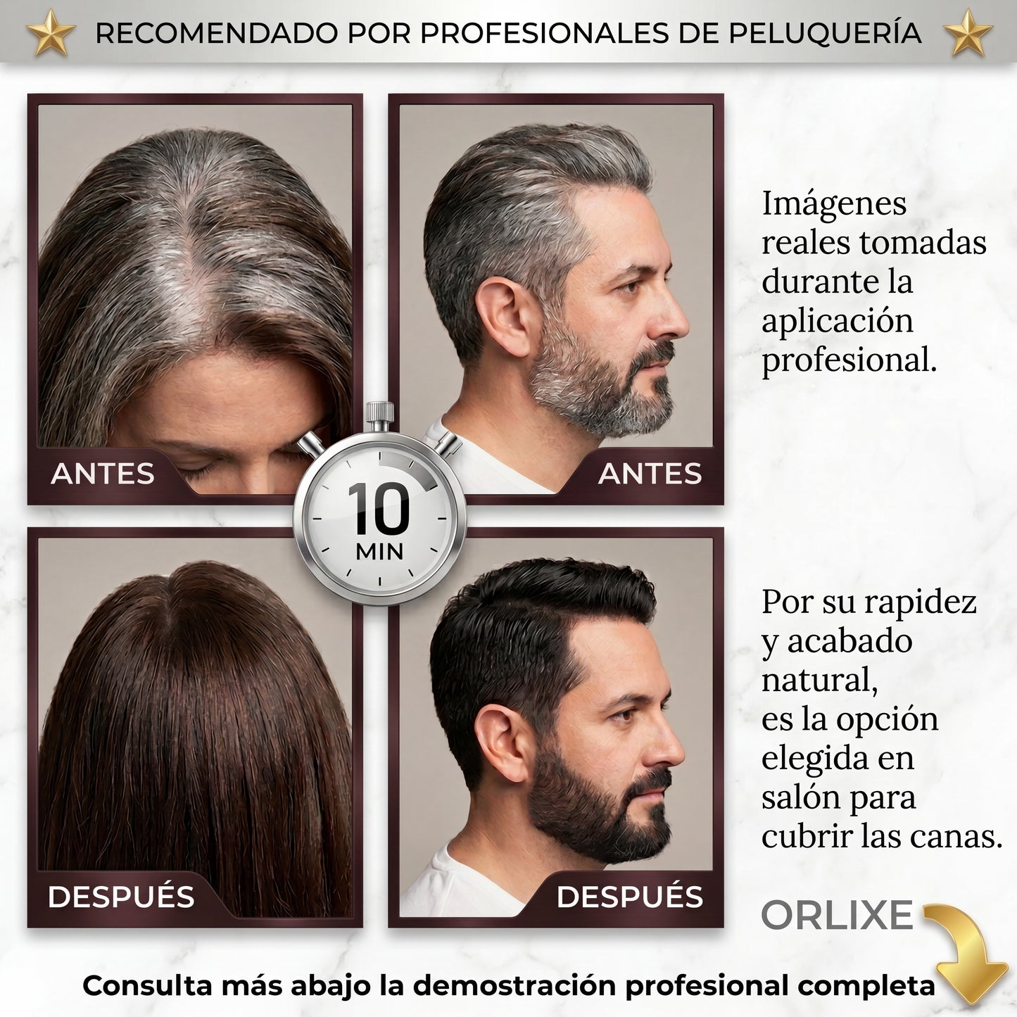 ORLIXE | Champú 3 en 1 Cero Canas