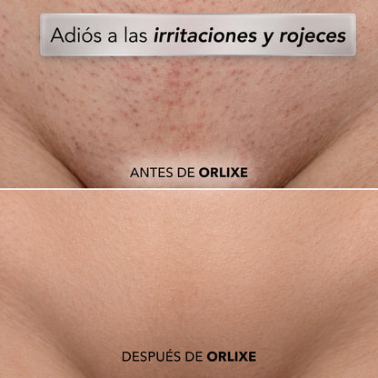 ORLIXE | Depiladora 2 en 1
