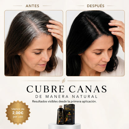 ORLIXE | Champú 3 en 1 Cero Canas